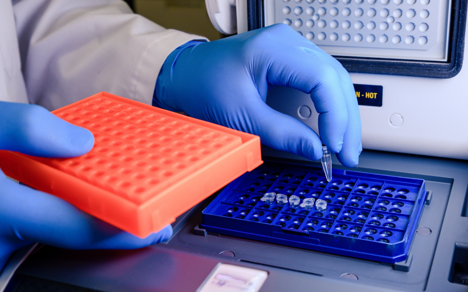 HPV DNA Testi Nasıl Yapılır?